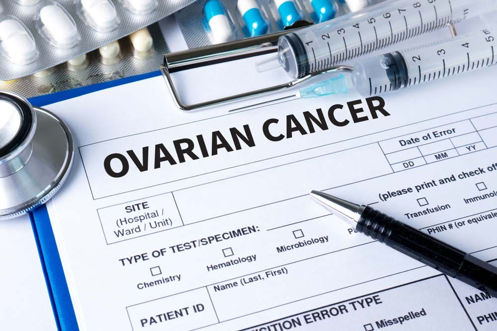 ovarian cancer